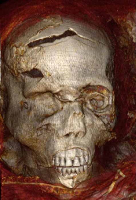 Ein CT-Scan von Seqenenres Gesicht zeigt Kopfwunden.