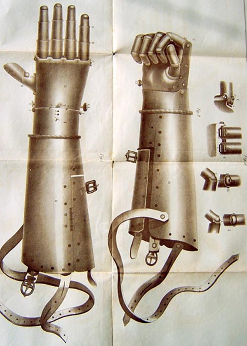 Die zweite Eisenprothese von Götz von Berlichingen
