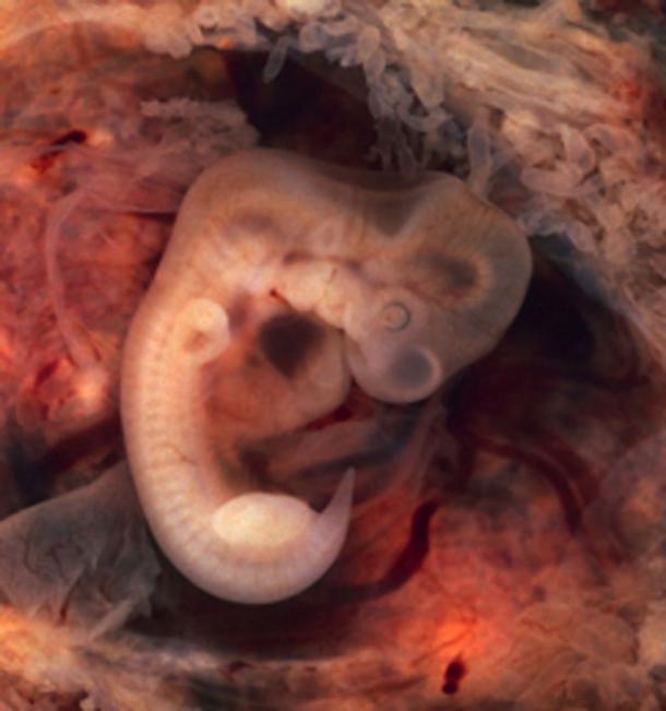Frühe Embryonen zeigen einige Merkmale der Vorfahren, wie den Schwanz dieses menschlichen Embryos. Diese Merkmale verschwinden normalerweise in der späteren Entwicklung, aber es kann nicht passieren, wenn sie einen Atavismus haben.