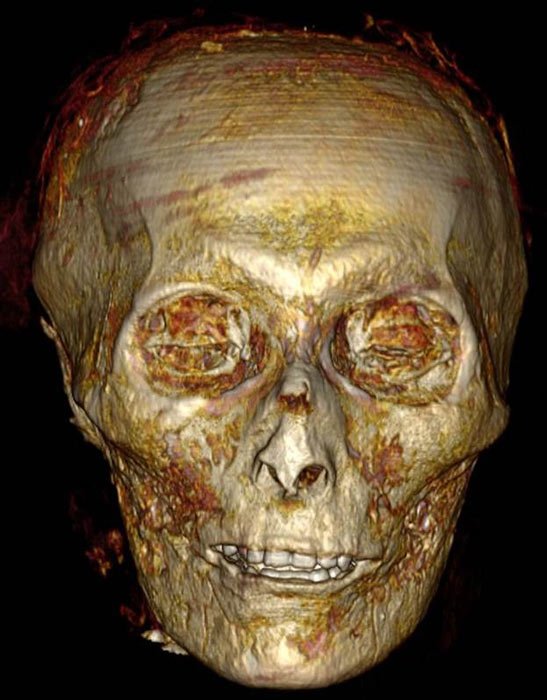 Die vollständige Gesichtsrekonstruktion von Pharao Amenhotep I. ist unheimlich und lässt uns immer noch rätseln, wie sein Leben wirklich aussah und wer er wirklich war. 