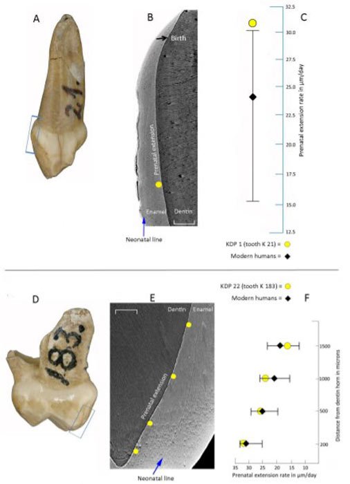 Die jüngste Studie, die sich auf fünf Babyzähne stützt, die in der Krapina-Fundstelle in Kroatien gefunden wurden, ergab, dass die Entwicklung von Neandertaler-Kindern schneller verlief als der Reifungsprozess bei modernen Menschen.