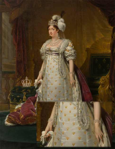 Madame Royale, die überlebende Tochter von Marie-Antoinette, Marie-Thérèse Charlotte von Frankreich, trägt die Armbänder auf einem Porträt des französischen Malers Antoine-Jean Gros aus dem Jahr 1816.
