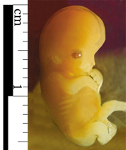 Ein menschlicher Embryo, sieben Wochen alt