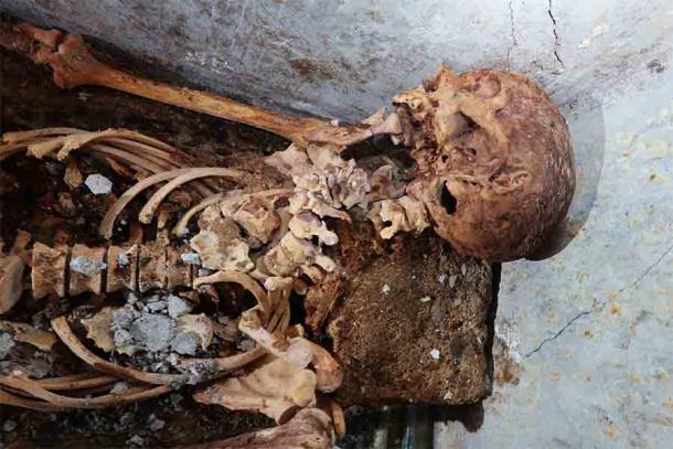Die 2000 Jahre alten Überreste wurden irgendwie teilweise mumifiziert und hinterließen Spuren von Haaren und Fleisch auf dem Schädel 
