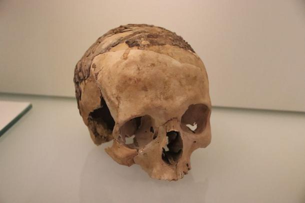 Einer der asphaltierten Schädel, die in Nahal Hemar entdeckt wurden.