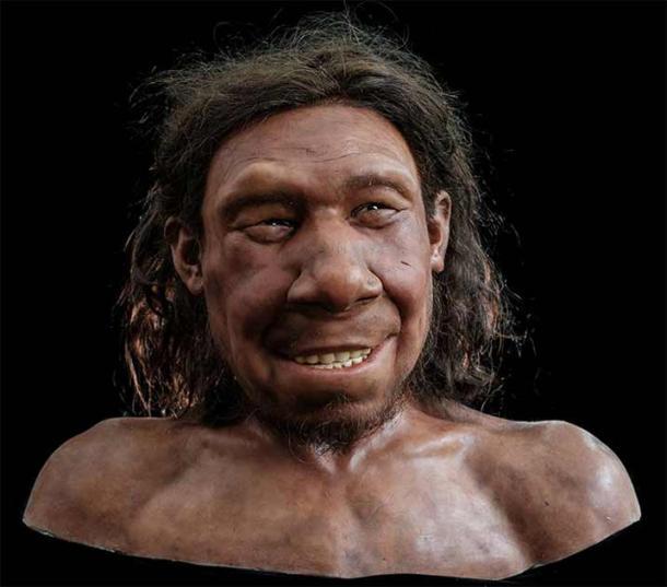 Man beachte die Beule über Krijns rechtem Auge, die den Tumor darstellt, der auf dem Schädelfragment zu erkennen war. 