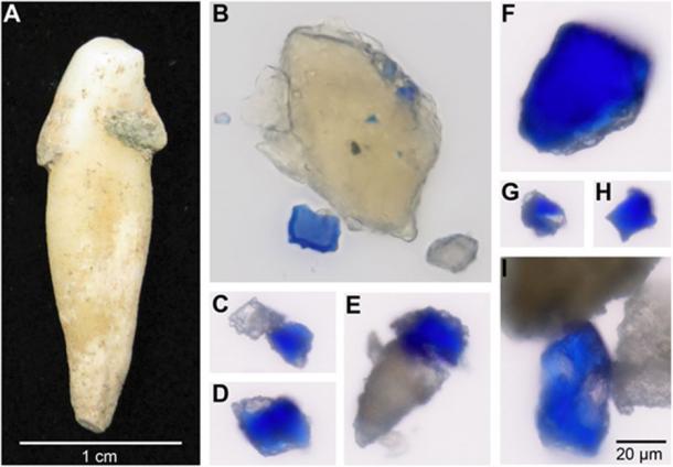 Blaue Partikel eingebettet in archäologischem Zahnstein. ( A) Archäologischer Zahn aus der Einzelprobe B78 mit anhaftenden Zahnsteinablagerungen vor der Probenahme. Die Bilder (B) bis (I) sind im gleichen Maßstab dargestellt, wie in (I) angegeben.