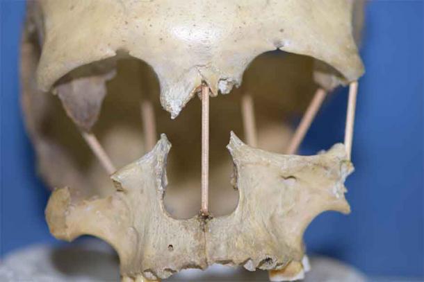 Die genetische Studie umfasst die gesamte Genomsequenz einer Frau, die vor 35.000 Jahren gelebt hat. Sie wurde einem Schädel entnommen, der in Rumänien in der Peştera Muierii-Höhle gefunden wurde.