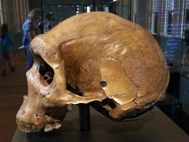 Der Kabwe-Schädel oder Broken Hill-Schädel mit seinem kugelförmigen Loch, das deutlich sichtbar ist, ist im National History Museum in London ausgestellt.