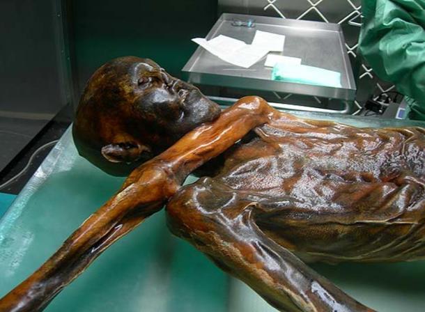 Die extreme Kälte hat Otzi außerordentlich gut erhalten