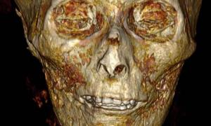 Gesicht von Amenhotep I. mit digitalem CT-Scan enthüllt