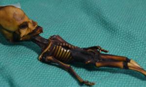 Das mumifizierte Skelett eines kleinen Mädchens, das 2003 in der chilenischen Wüste gefunden wurde