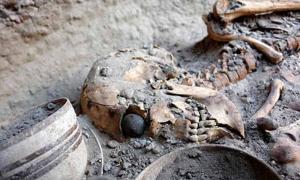 Künstliche Augen aus dem Iran vor 5.000 Jahren!
