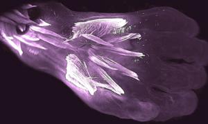 Hochauflösende 3D-Mikroskopbilder haben Wahrheiten über die frühe menschliche Entwicklung aufgedeckt!