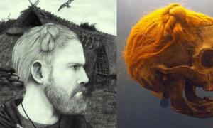 Die glorreichen Haare von Osterby Man