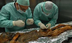 Älteste bekannte menschliche Blutzelle in Ötzi gefunden.
