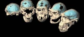 Alte Menschen mit mehr affenähnlichen Gehirnen